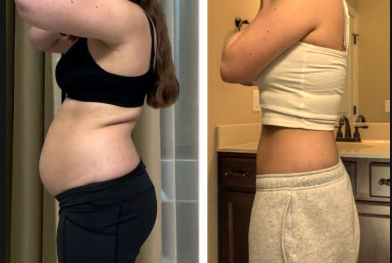 Member body transformation — side profile before and after
